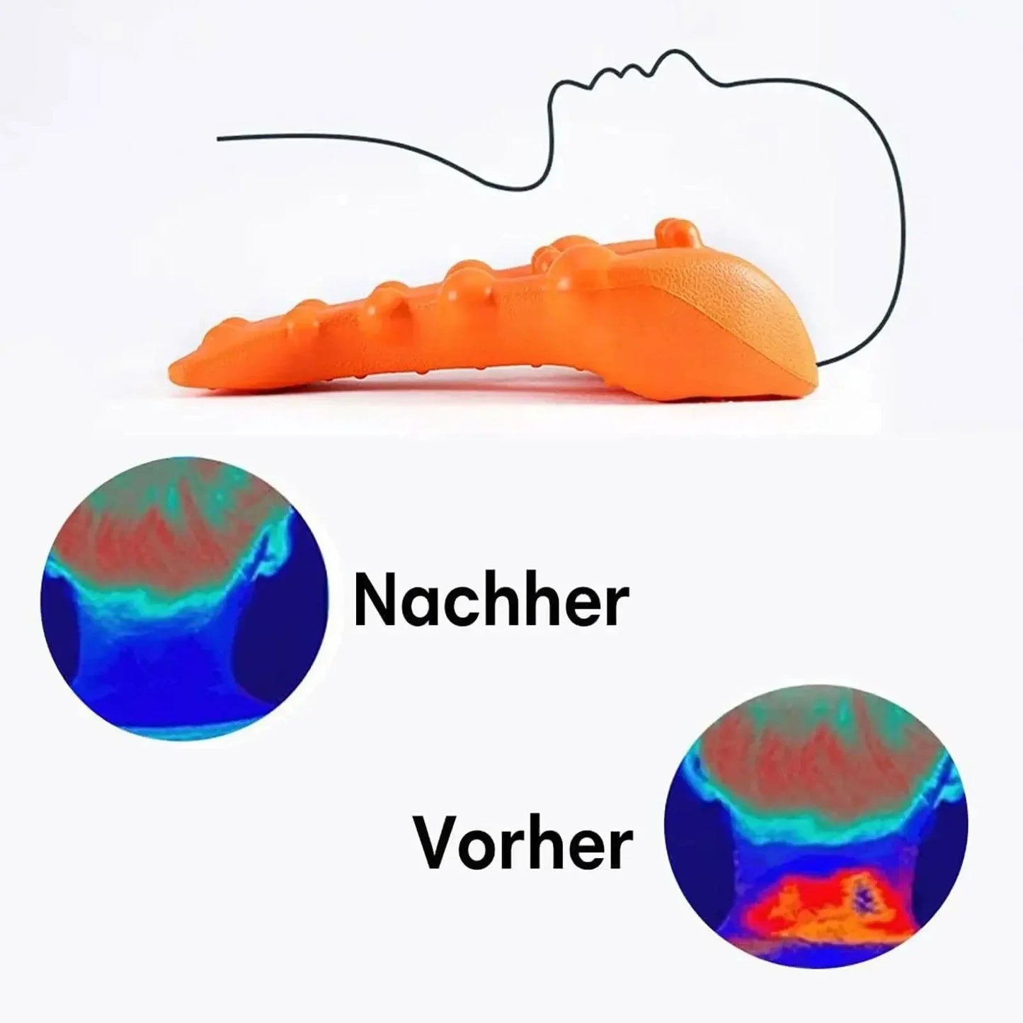 Cervical Neck Stretcher - Trigger Point Massage & Traction Device